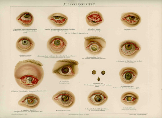 Очни болести